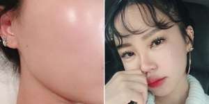 Rahasia Dapatkan Wajah 'Glass Skin' ala Cewek Korea