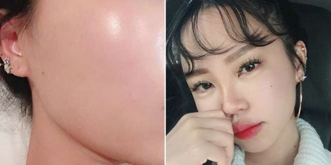 Rahasia Dapatkan Wajah 'Glass Skin' ala Cewek Korea