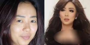 `Before-After` Wajah Soimah, Percaya?