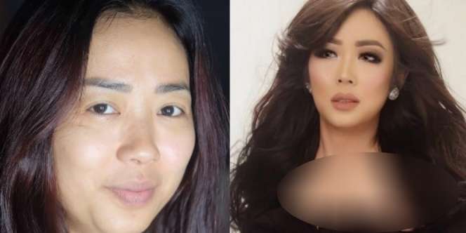 `Before-After` Wajah Soimah, Percaya?