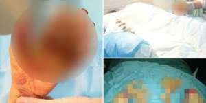 Kisah Nyata, Jari Putus karena Berzina