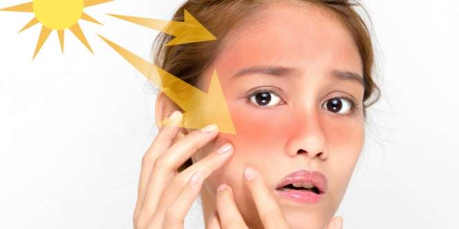 3 Jenis Sinar Ultraviolet Mataharia, Mana Paling Bahaya?