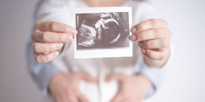 Pakar Kesuburan Ungkap Cara Agar Hamil Anak Perempuan