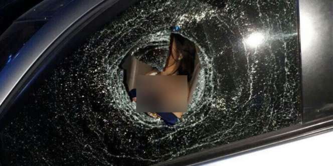 Beredar Foto DJ Siska Berdarah di Mobil, Penyebabnya...