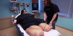 Sulit Dikenali, Ini Perubahan Drastis Wanita Berbobot 300 Kg