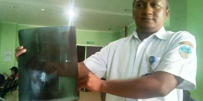 Nasib Pria yang Perutnya Berisi Paku, Kini...