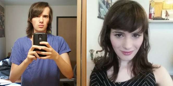 Transformasi 17 Bulan, Si Pria Jadi Wanita Usai Suntik Hormon