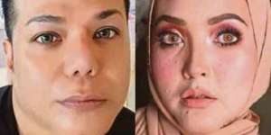 Suntik Kolagen Agar Cantik, yang Terjadi Malah...