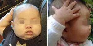 Bayi Lucu Ini Sering Sentuh Kepala Tanpa Alasan, Ternyata..