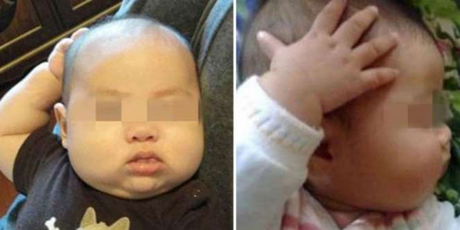 Bayi Lucu Ini Sering Sentuh Kepala Tanpa Alasan, Ternyata..