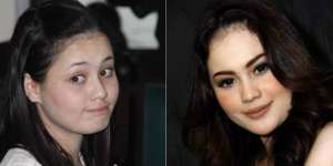 Beredar Foto Jennifer Dunn Lagi Oplas, Syok Lihatnya!