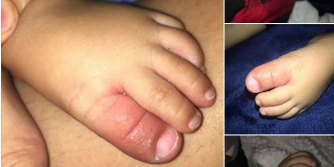 Haram Mencium Bibir Bayi, Bisa Menularkan Herpes