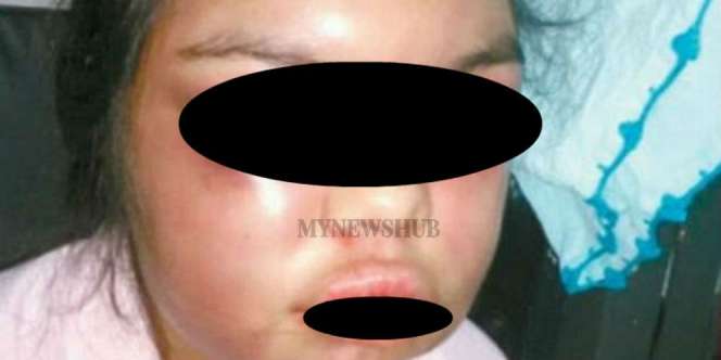 Istri Dipukuli Suami Tiap Kali Dapat Likes di Facebook