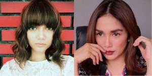 Deretan Seleb yang Mengaku Tanam Benang demi Kecantikan