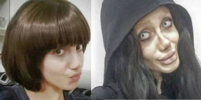 Oplas 50 Kali Demi Jadi Angelina Jolie, Si Gadis Malah Mirip..
