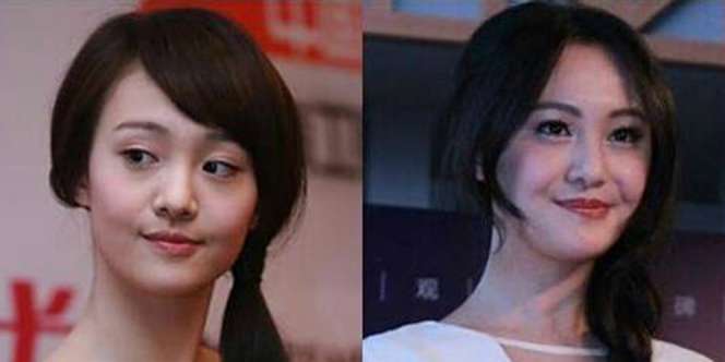 Artis Cantik Oplas Usai Putus Cinta, Wajah Berubah Jadi..