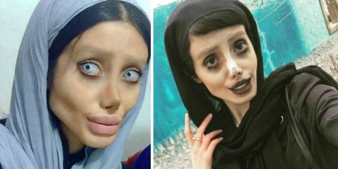 Terkuak Fakta Sebenarnya Gadis Oplas Mirip Angelina Jolie