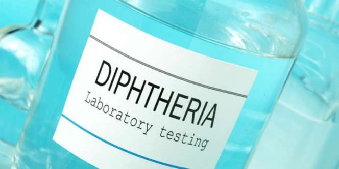 Difteri Bisa Berujung Gagal Jantung Hingga Kerusakan Saraf