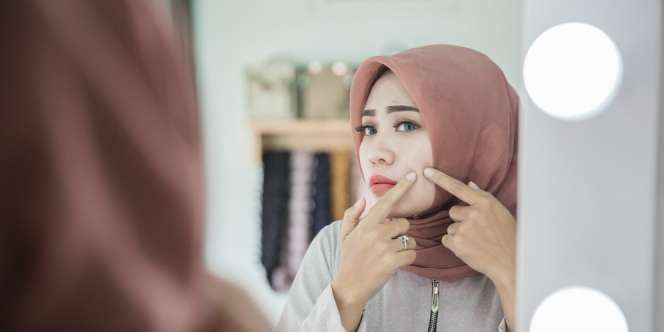 Basmi Komedo dengan Bahan Kue Ini, 15 Menit Dijamin Minggat