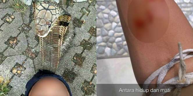 Detik-detik Remaja Bandung Tewas Digigit Ular Kobra