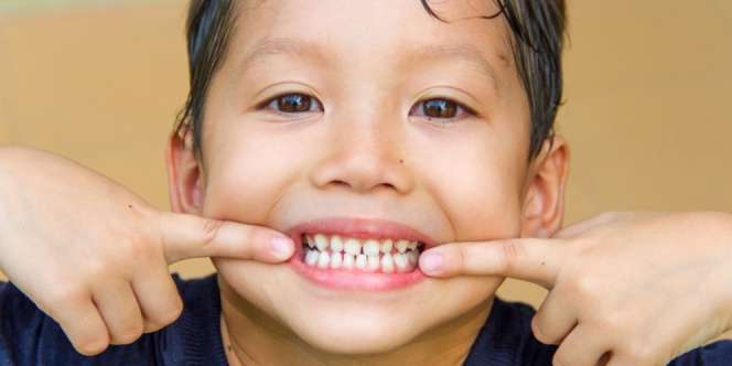 Kapan Gigi Tetap Si Kecil Mulai Tumbuh?