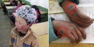 Sampai Sekolah Rambut Memutih, Haru Lihat Perjuangan Bocah Ini