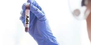 Virus Pemicu Kanker Serviks Bisa Menyerang Organ Lain