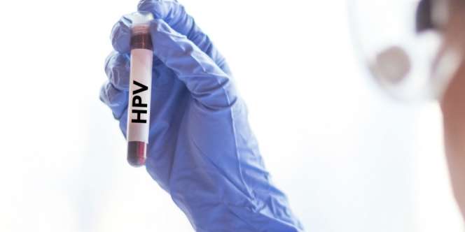 Virus Pemicu Kanker Serviks Bisa Menyerang Organ Lain