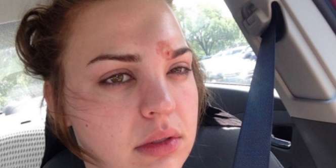 Lupa Bersihkan Kuas Makeup, Nyawa Wanita Ini Hampir Melayang