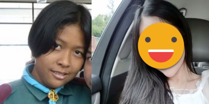 Dicampakkan Karena Jelek, Perubahan Gadis Ini Mencengangkan