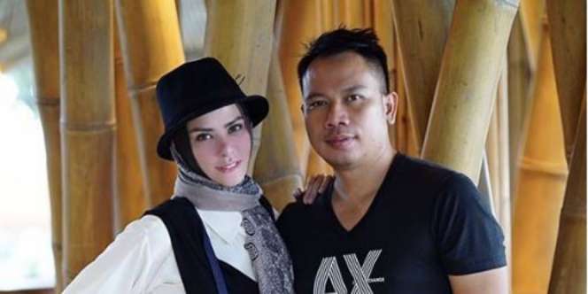 Perawatan Wajah Vicky Prasetyo Jelang Pernikahan