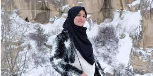 Shireen Sungkar Alami Hipersalivasi Saat Hamil, Apa Itu?