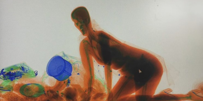 Takut Agpao Dalam Tas Raib, Si Wanita Ikut Masuk Mesin X-Ray