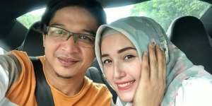 Ada Perbedaan di Wajah, Istri Pasha 'Ungu' Lakukan Oplas?