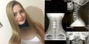 Coba Variasi Sit-Up, Fatal Akibatnya!