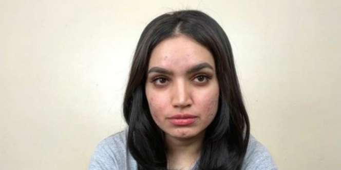 Brand Kecantikan Tolak Kerjasama dengan Model Berjerawat