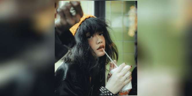 Wajah Babak Belur, Dylan Curhat Jadi Korban Kekerasan