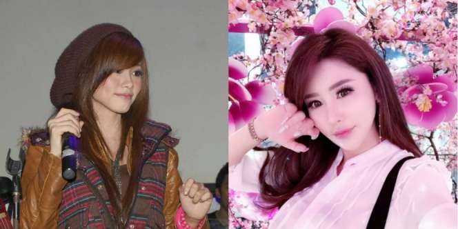 Perubahan Drastis Wajah Dyna Idol, Mirip Artis K-Pop