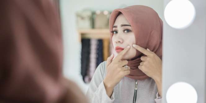 4 Langkah Memencet Jerawat yang Benar Agar Tidak Membekas
