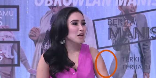 Ayu Ting Ting Dibanting Bintang Tamu, Lengan Sampai Memar!
