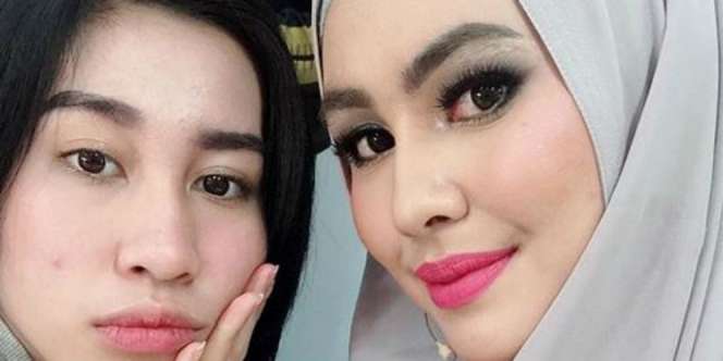 Tak Kalah Cantik, Adik Kartika Putri Jadi Sorotan