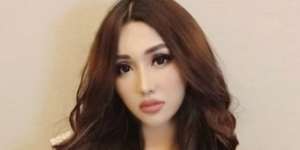 Cantik Maksimal, Terungkap Biaya Oplas Lucinta Luna