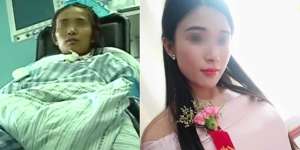 Kecapean Jadi Pagar Ayu 2 Hari, Kaki Gadis Diamputasi