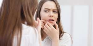 Nurul: Jangan Ucapkan 9 Kalimat Ini ke Orang yang Jerawatan