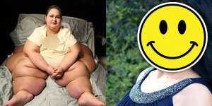 Wanita Berbobot 500 Kg, Tak Disangka Penampilannya Kini...