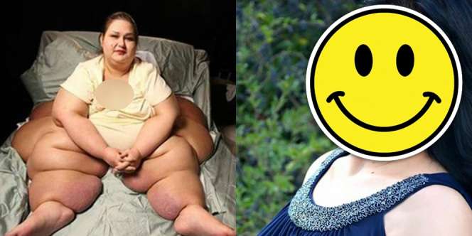 Wanita Berbobot 500 Kg, Tak Disangka Penampilannya Kini...