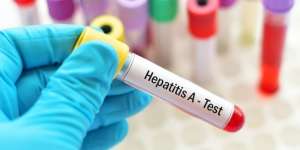 Harapan Baru Penderita Hepatitis & Sirosis di Indonesia