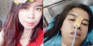 Gadis Ini Terserang Strok karena Keseringan Main Mobile Legend