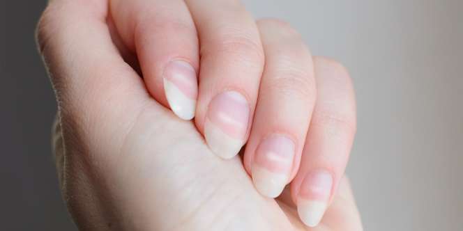 Muncul Bintik Putih di Kuku? Hilangkan Dengan 5 Cara Alami Ini