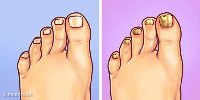 Lima Tanda di Area Kaki Ini Tunjukan Kondisi Kesehatan Kamu